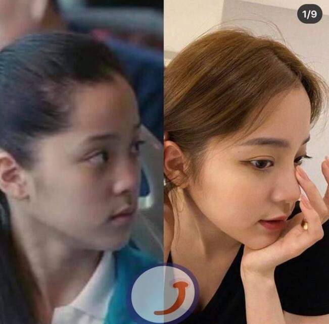 姐姐谈欧阳娜娜整容